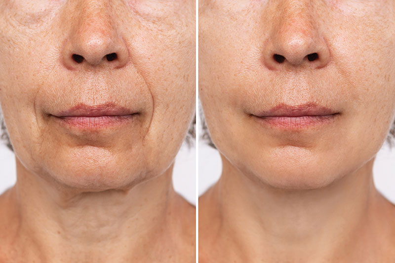 Expert Dermatologists Share The New Rules of Skincare
